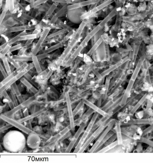 Скопление створок диатомовых водорослей под микроскопом (масштаб указан). Фото Захара Слуковского